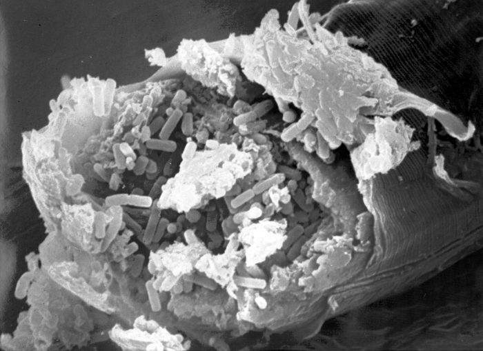 bacillus thuringiensis